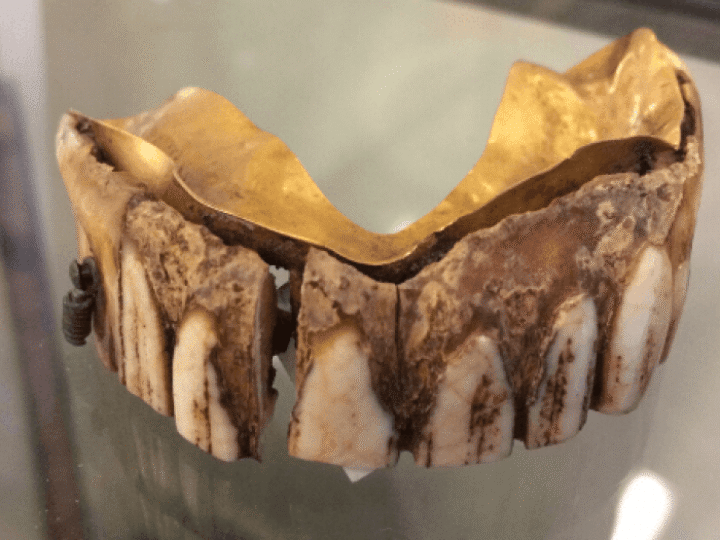 Find to get your teeth into – 200-year-old &#8216;hippo ivory&#8217; dentures discovered in field